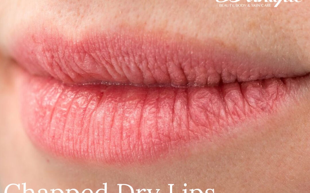 Chapped dry lips